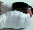 bandaged hands.jpg